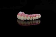 152973420-high-quality-dental-prosthesis-made-by-dental-technician-prosthesis-with-a-pink-gingiva-to-fix-after